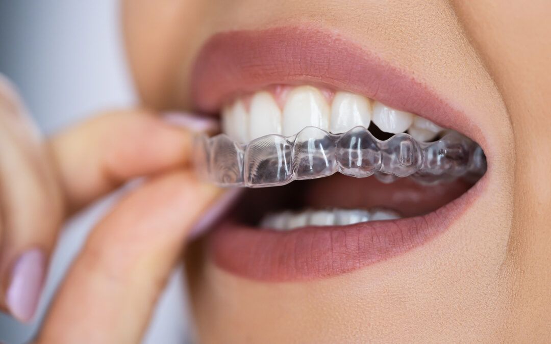 Patient holding a clear invisible teeth aligner tray at The Tooth Corner, Bellandur
